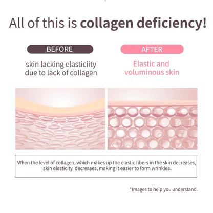Before and after results of MACQUEEN Collagen Vita Balm – visibly smoother, firmer skin